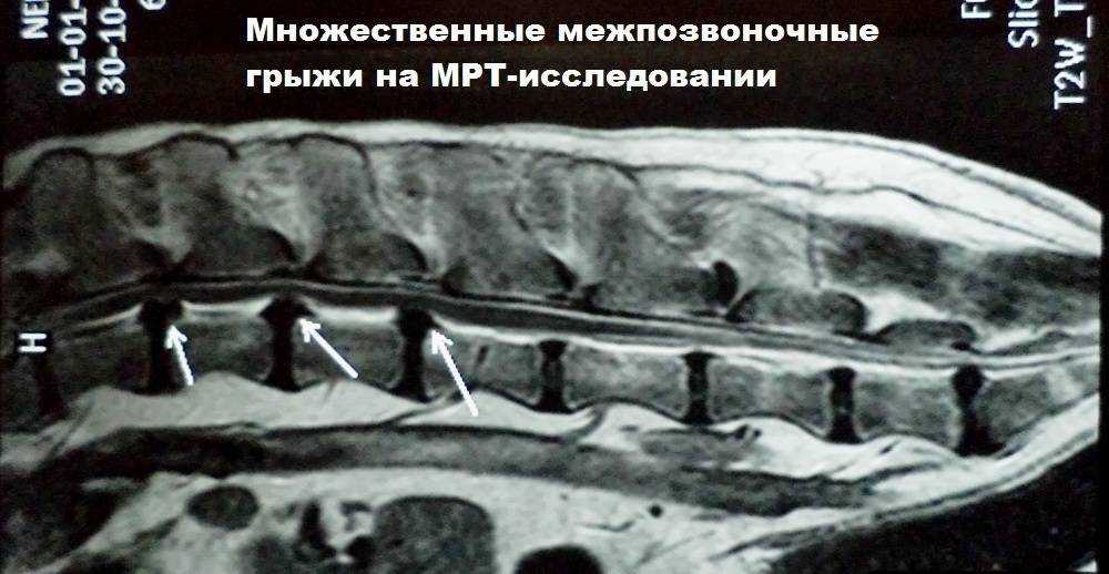 Невропатолог. что это за врач и что он лечит? когда следует к нему обращаться? что происходит на приеме?