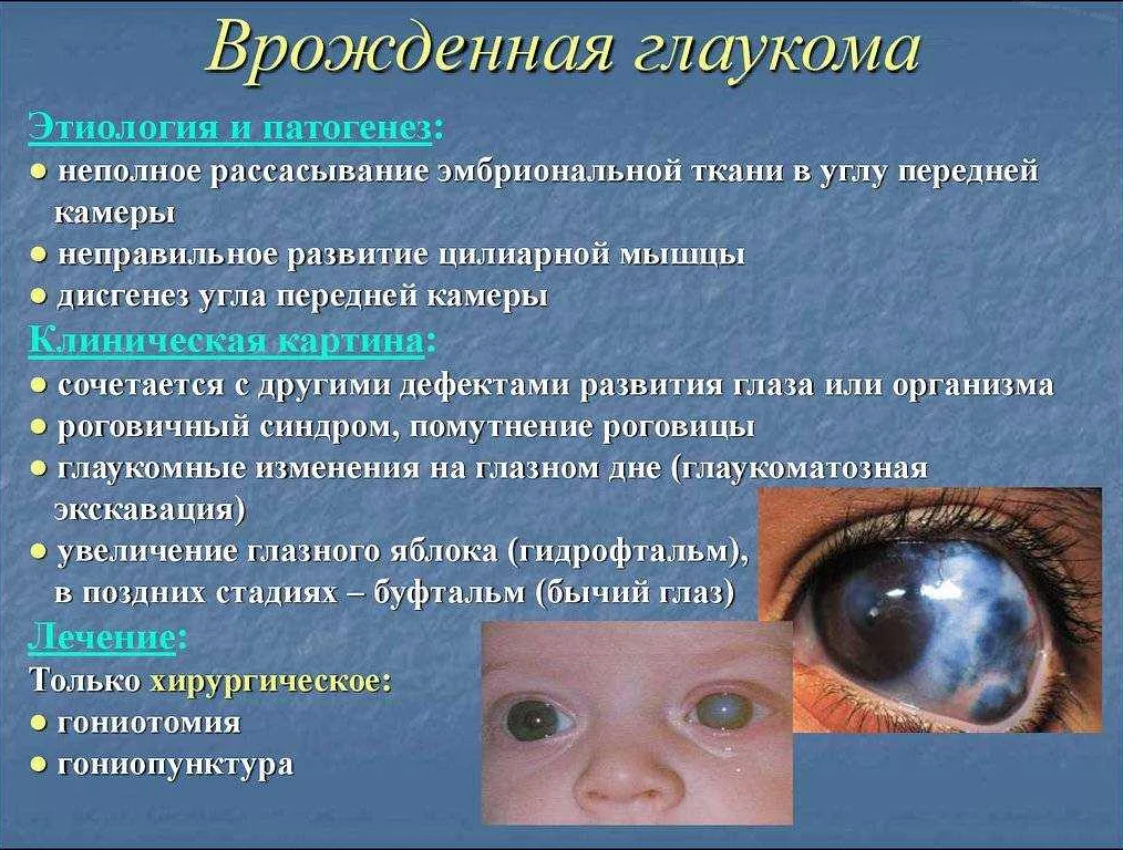 Глаукома у кошек