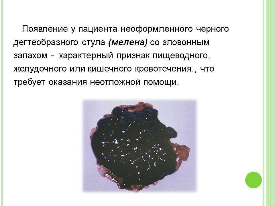 Нормальный кал у собаки имеет плотную консистенцию с оттенком от светло до темно коричневого Появление отклонений в испражнениях должно стать поводом для срочного посещения ветеринарной клиники
