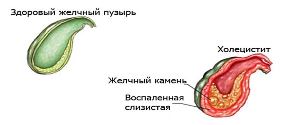 Холецистит у собак: симптомы воспаления и лечение желчного пузыря у собак, прогнозы, диета, профилактика