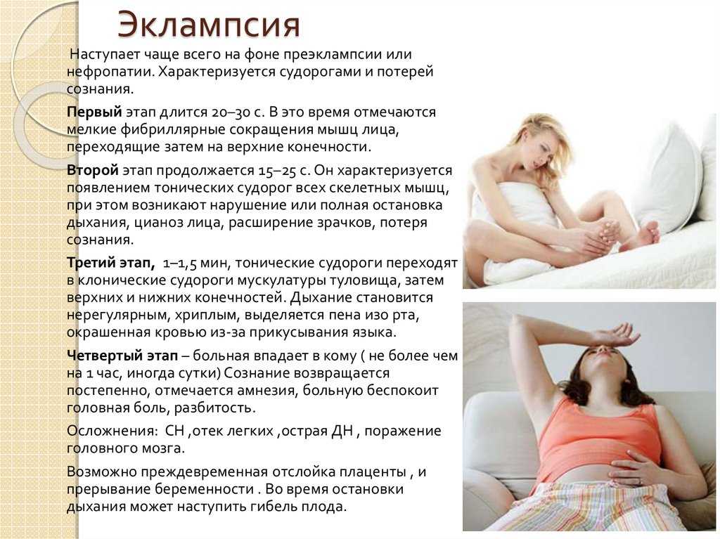 Послеродовая эклампсия у кошек симптомы, лечение, профилактикапослеродовая эклампсия у кошек симптомы, лечение, профилактика