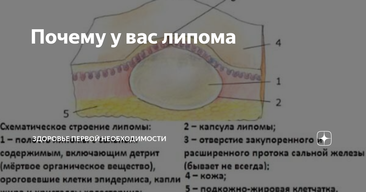 У кошки на позвоночнике жировик