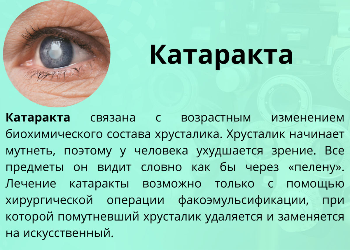 8 распространенных проблем со зрением у собак