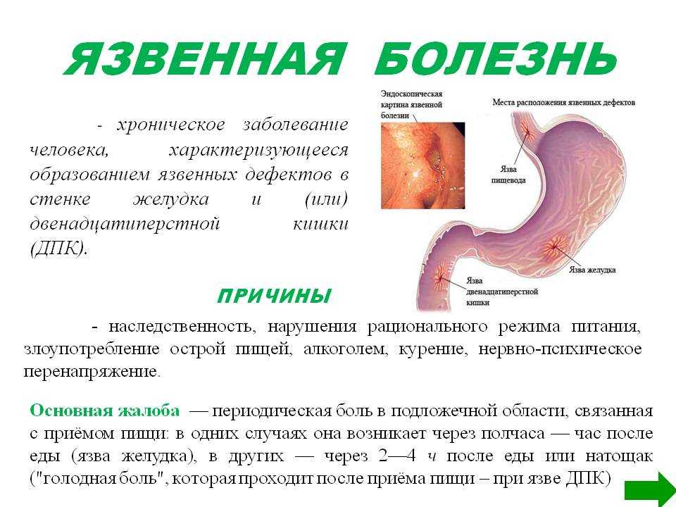 По каким признакам можно определить что у собаки язва Как ухаживать и чем кормить собаку во время лечения Отвечаем на эти и другие вопросы