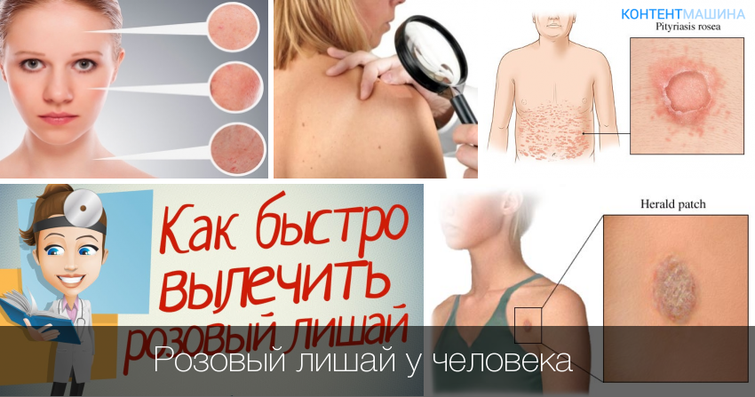 Симптомы отрубевидного лишая у собак и лечение