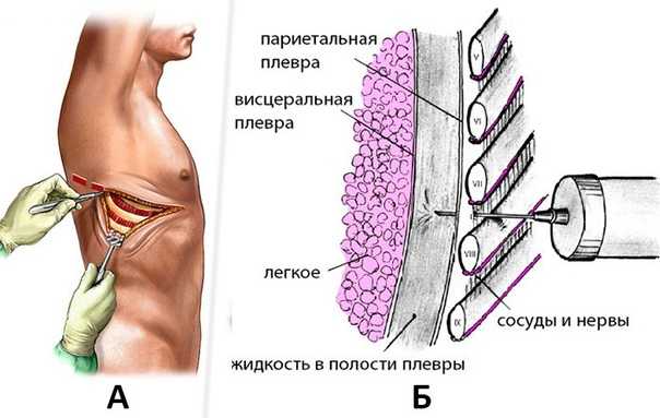 Гкмп у кошек: виды, причины, признаки, диагностика и терапия