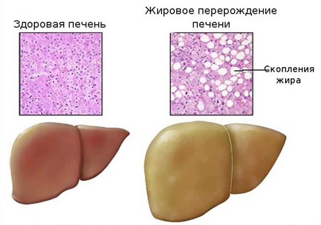 Коэффициент ритиса повышен у собаки: что это значит
