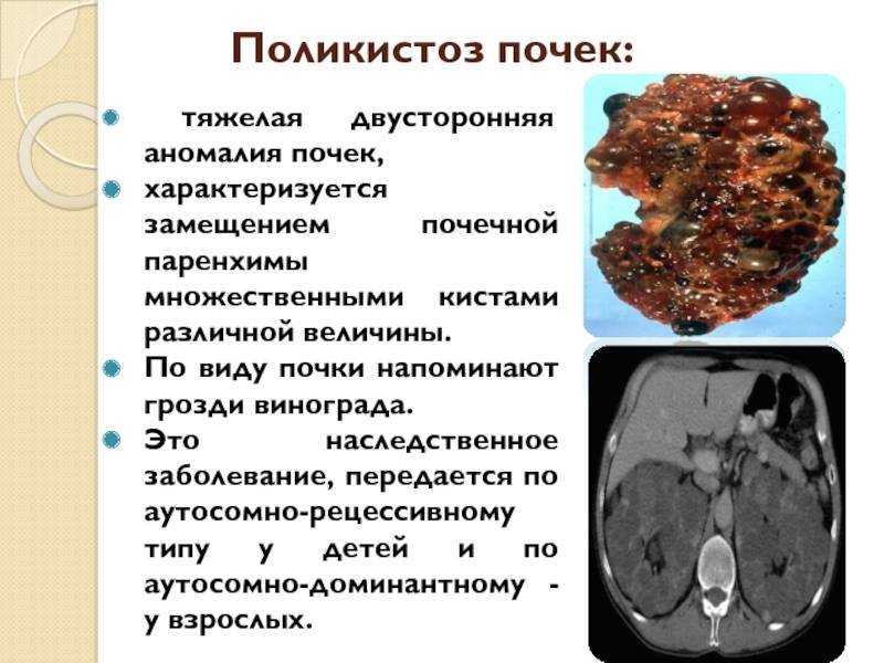 6 симптомов поликистоза почек у кошек: что делать