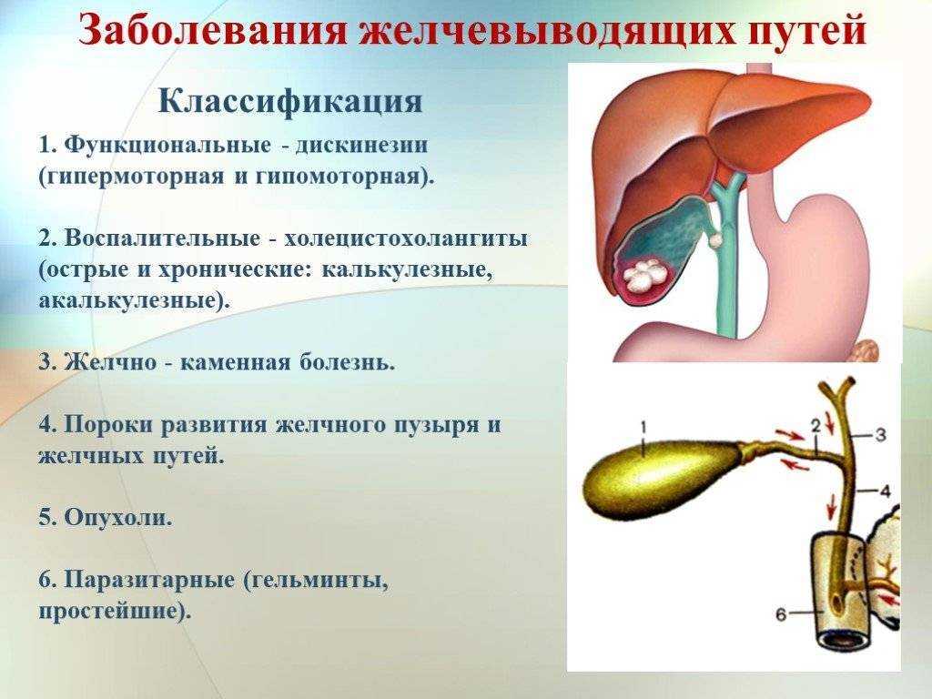 Холецистит первичное заболевание билиарной системы