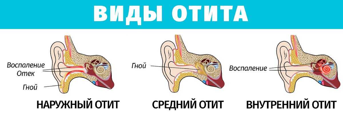 Отит у кошек - симптомы и лечение