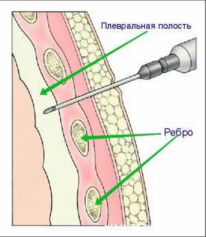 Гидроторакс у кошки
