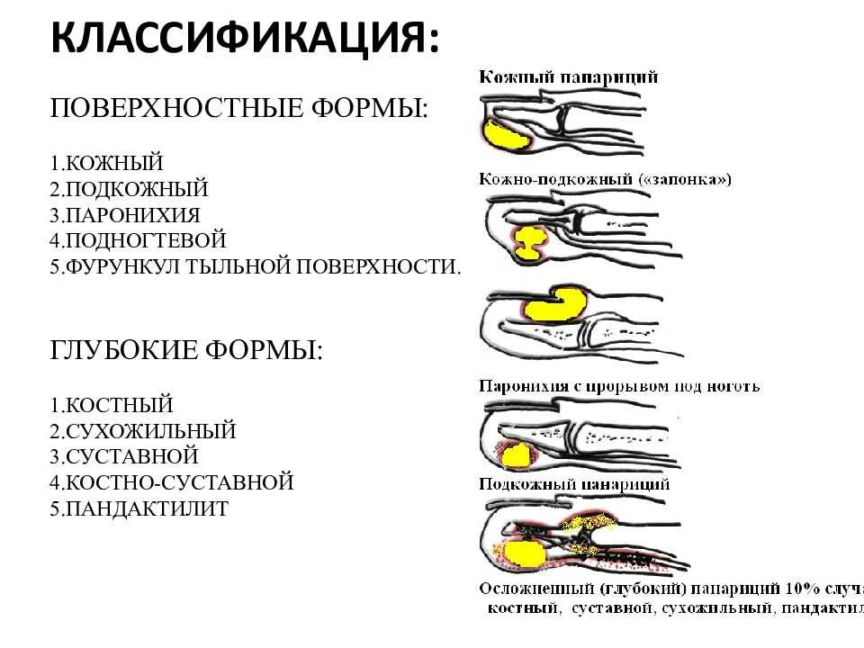 Собака сорвала ноготь первая помощь