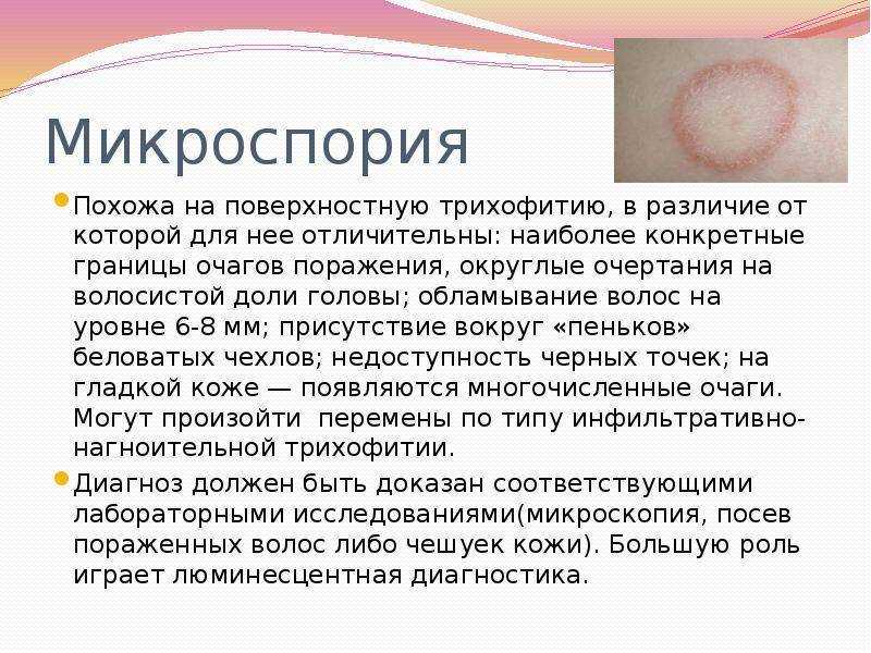 Лишай у собаки: причины, симптомы, диагностика, фото и лечение