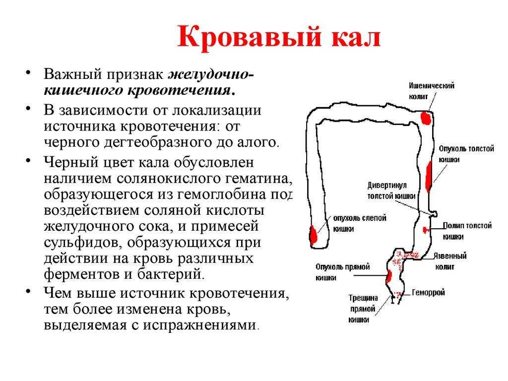 Кровь в кале у кота: как распознать кровь в кале у кошки, причины крови в кале у кошки, кровь в кале у маленького котенка