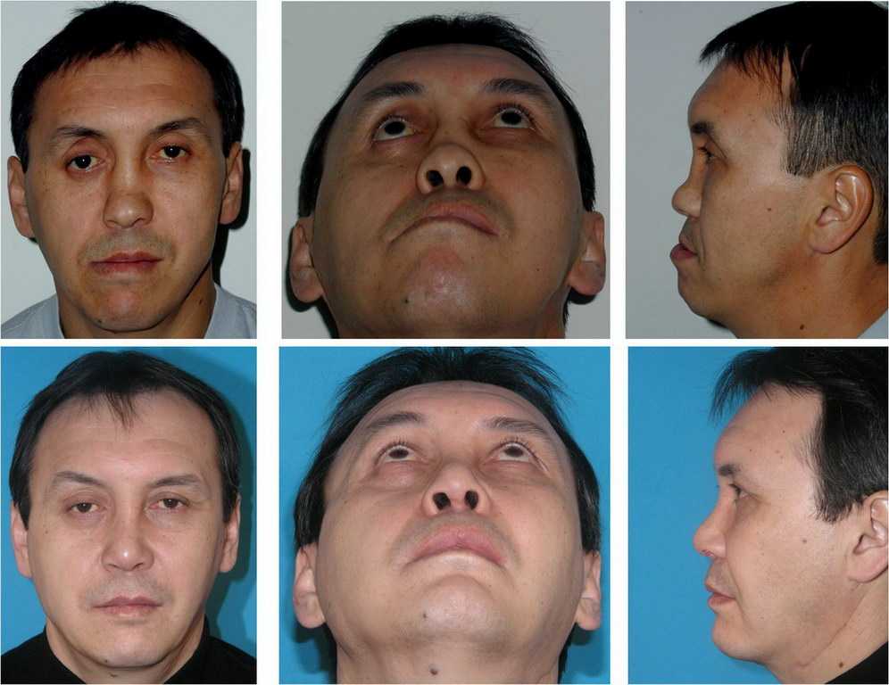 Перелом нижней челюсти у кошек. ветеринарная клиника "зоостатус"