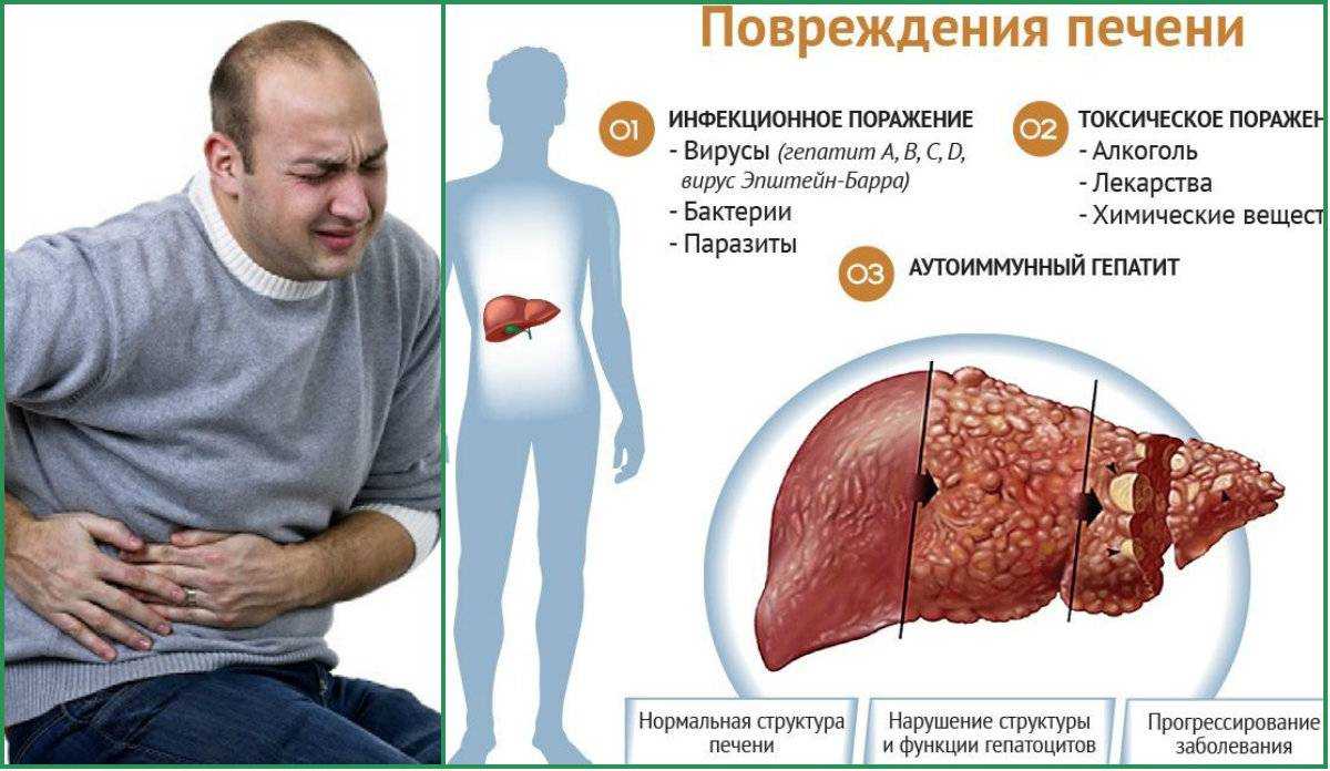 Печеночная недостаточность у кошек: причины возникновения, симптомы и 7 самых частых заболевания органа.
