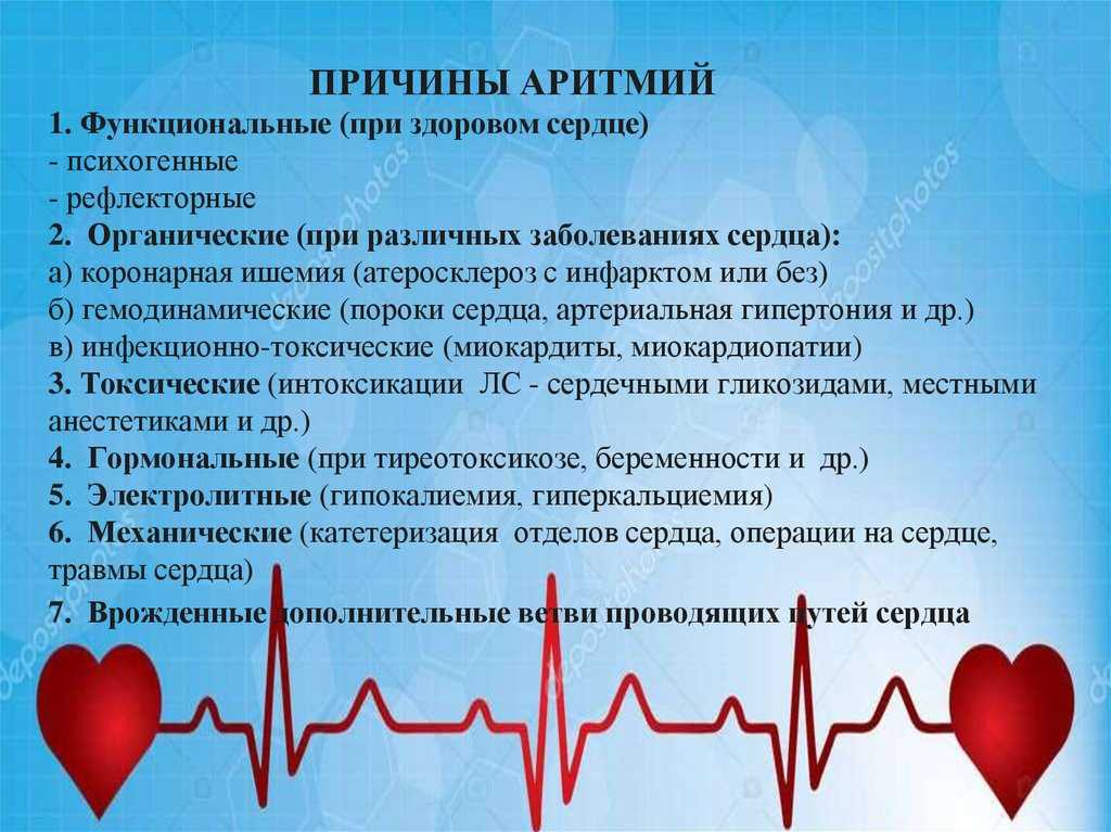 Аритмия у собаки