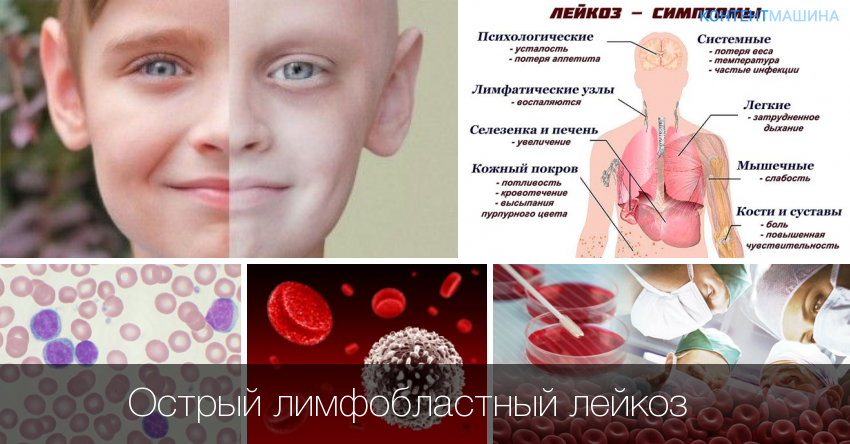 Диагностика и лечение лейкозов собак и кошек. онкология у собак острый лейкоз у собак