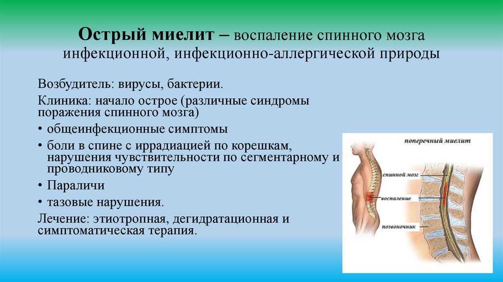 Энцефалит у кошек: симптомы и лечение заболевания