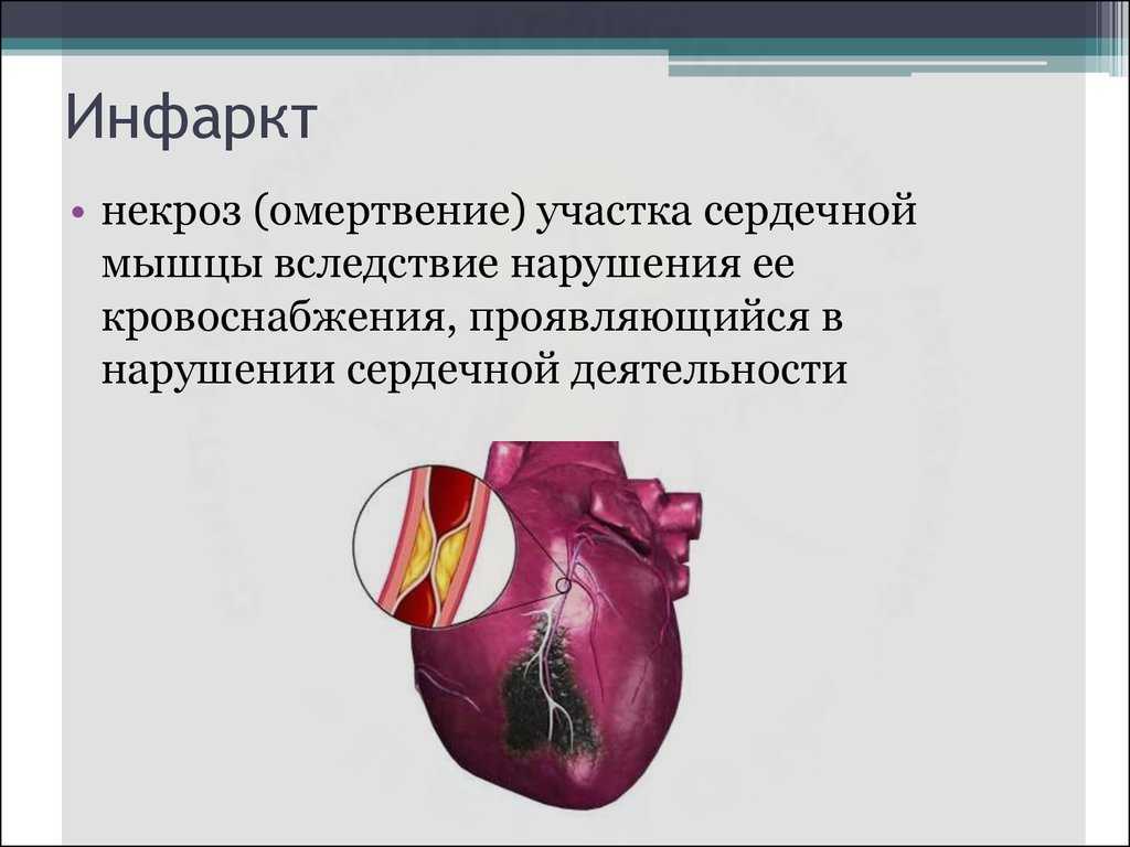 Разбираемся в причинах инфаркта у собаки и способах его лечения | ваши питомцы