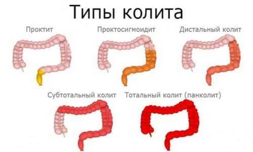 Колит у кошки: симптомы и лечение в домашних условиях | звери дома
