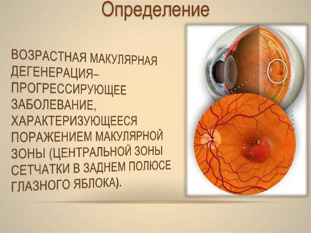 Витамины от сухости глаз: какие выбрать?