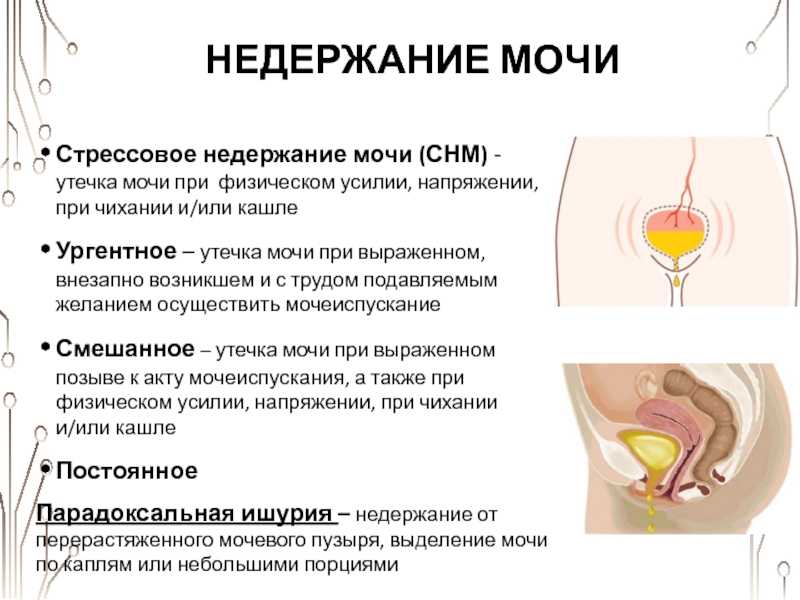 Недержание мочи у собаки после кастрации
