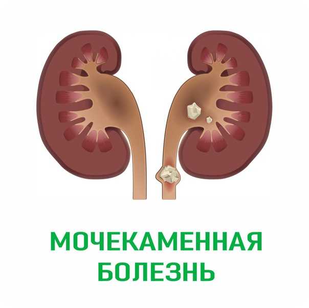 Мочекаменная болезнь у котов: причины, симптомы, диагностика, лечение, профилактика