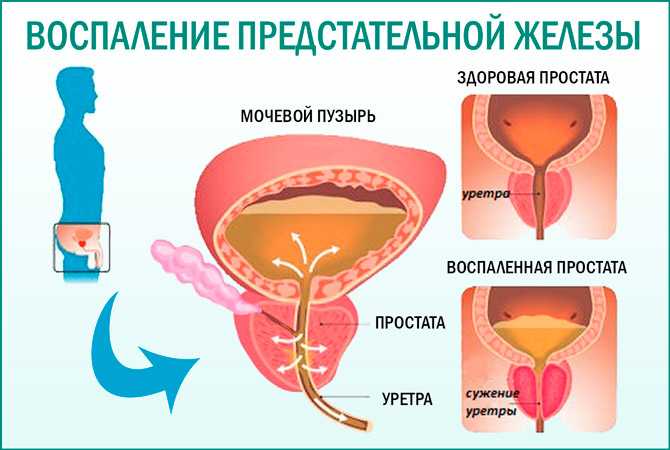 Анатомия, физиология, диагностика заболеваний простаты у кобелей – научные статьи о ветеринарии животных
