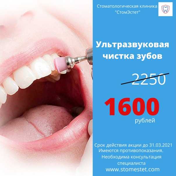 Нужно ли чистить зубы кошкам. когда нельзя чистить зубы кошке. пошаговая инструкция по чистке зубов кошке в домашних условиях. другие способы чистки зубов кошке.