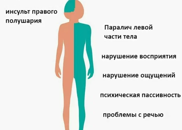 Шотландская кошка хромает: причины и лечение