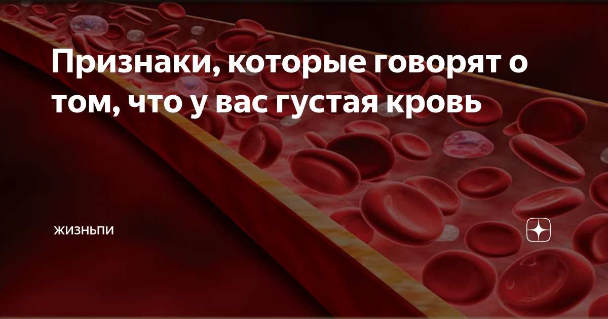 Сердечная недостаточность у кошек и котов: симптомы и лечение, осложнения, прогнозы, необходимость диагностики