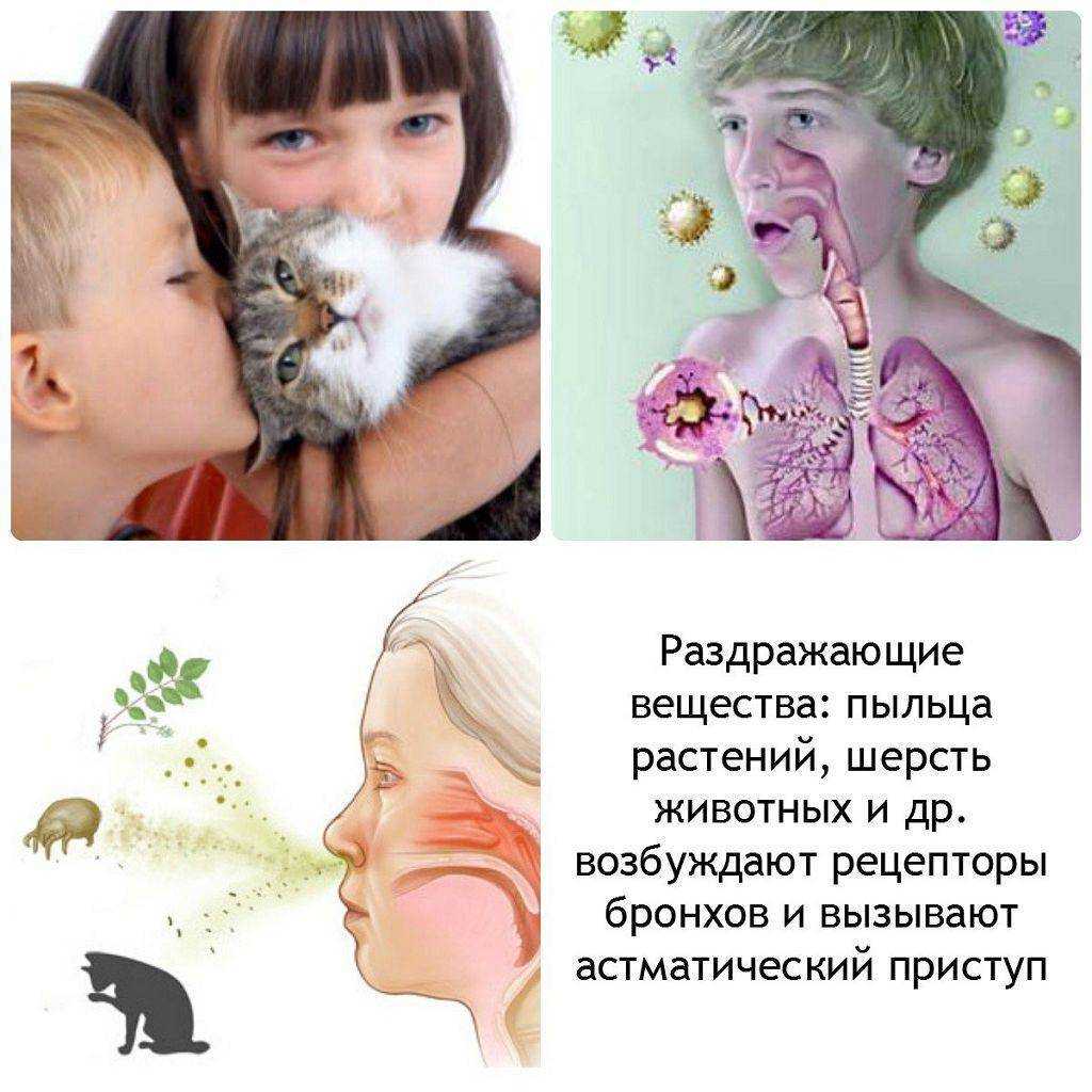 Аллергия на кошек: симптомы проявления у детей и взрослых