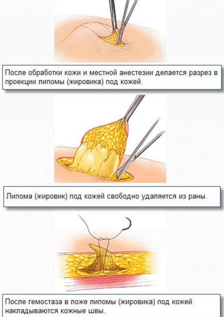 У кошки под кожей шарик