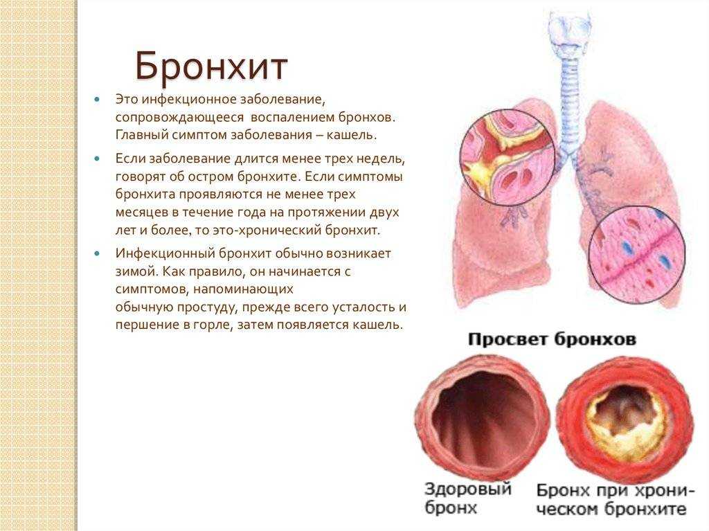 Бронхит у собак: симптомы и лечение