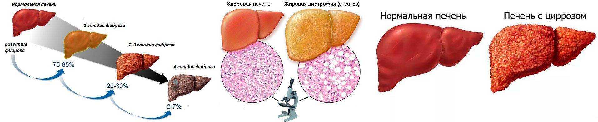Вся необходимая информация о циррозе печени у собак