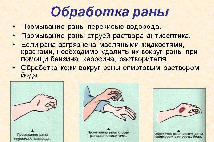 Лечение незаживающих ран