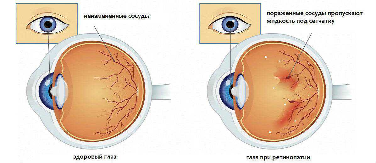 Витамины для глаз