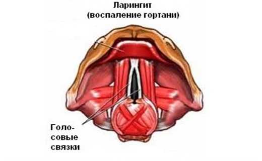 Кот кашляет - как будто хочет вырвать, хрипит, причины, лечение кашля