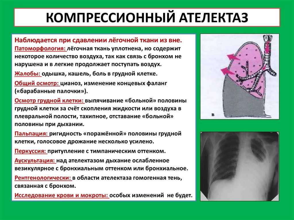 Пневмония у кошек - причины, симптомы и методы лечения