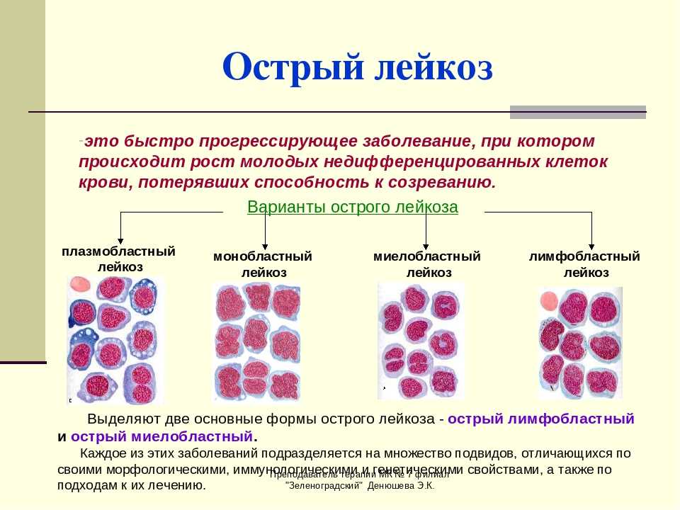 Как долго собака может жить с хроническим лимфоцитарным лейкозом? - on secret hunt