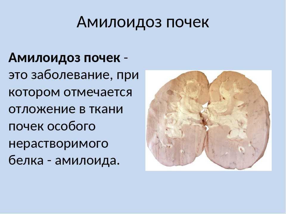 Болезни почек у кошек: симптомы и лечение, методы профилактики