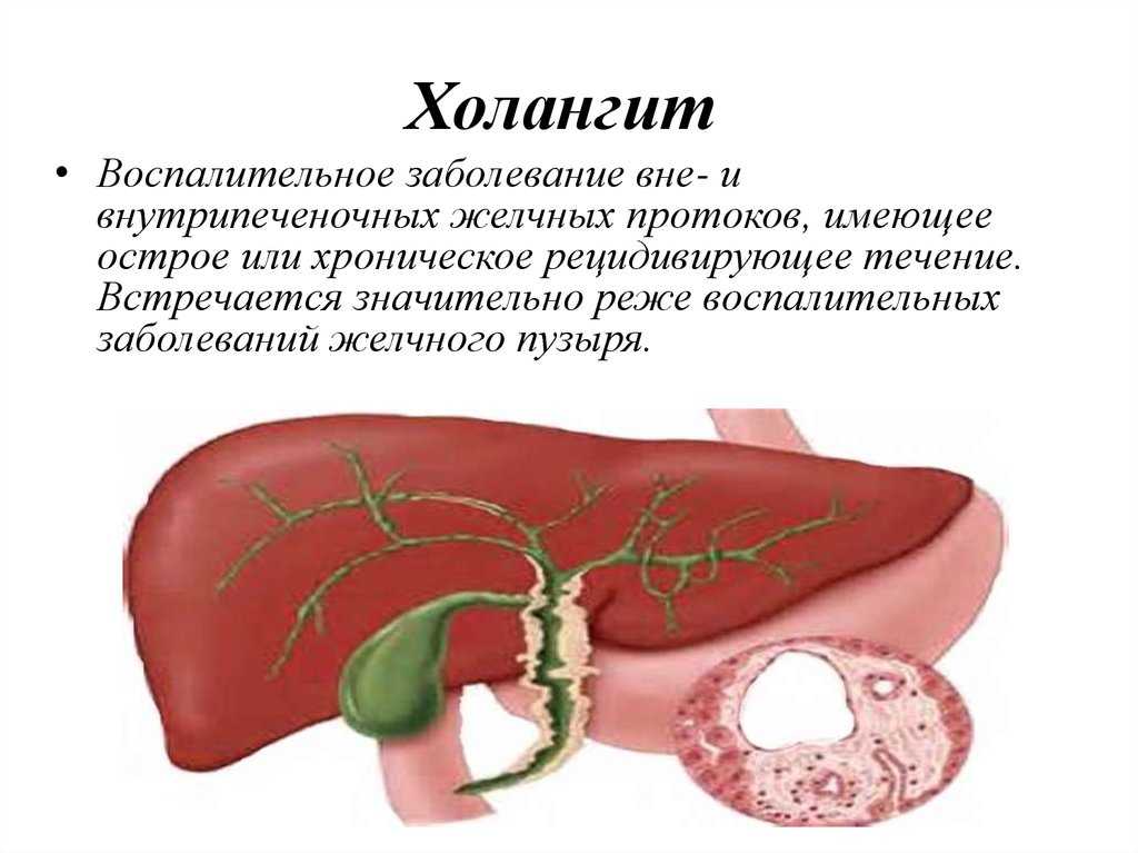 Холецистит у собак: причины, симптомы и этапы лечения