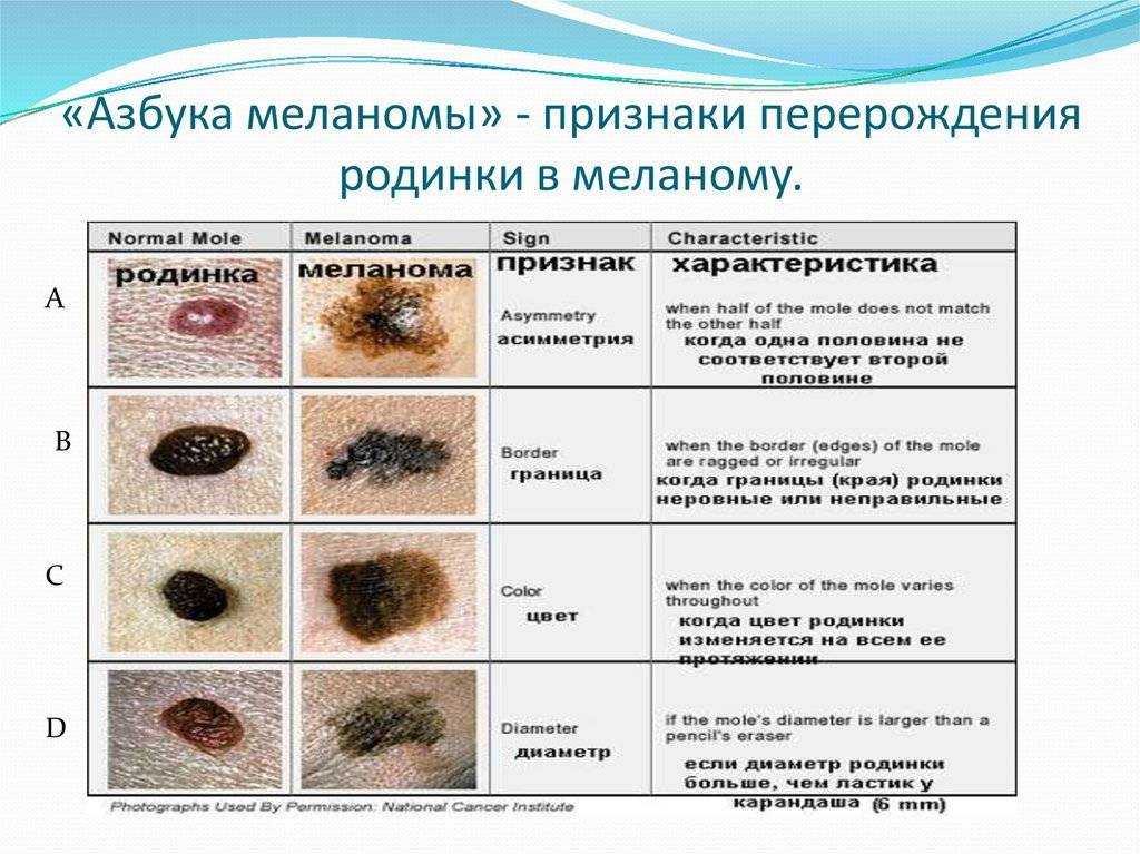 Отчего появляются жировики у собаки?