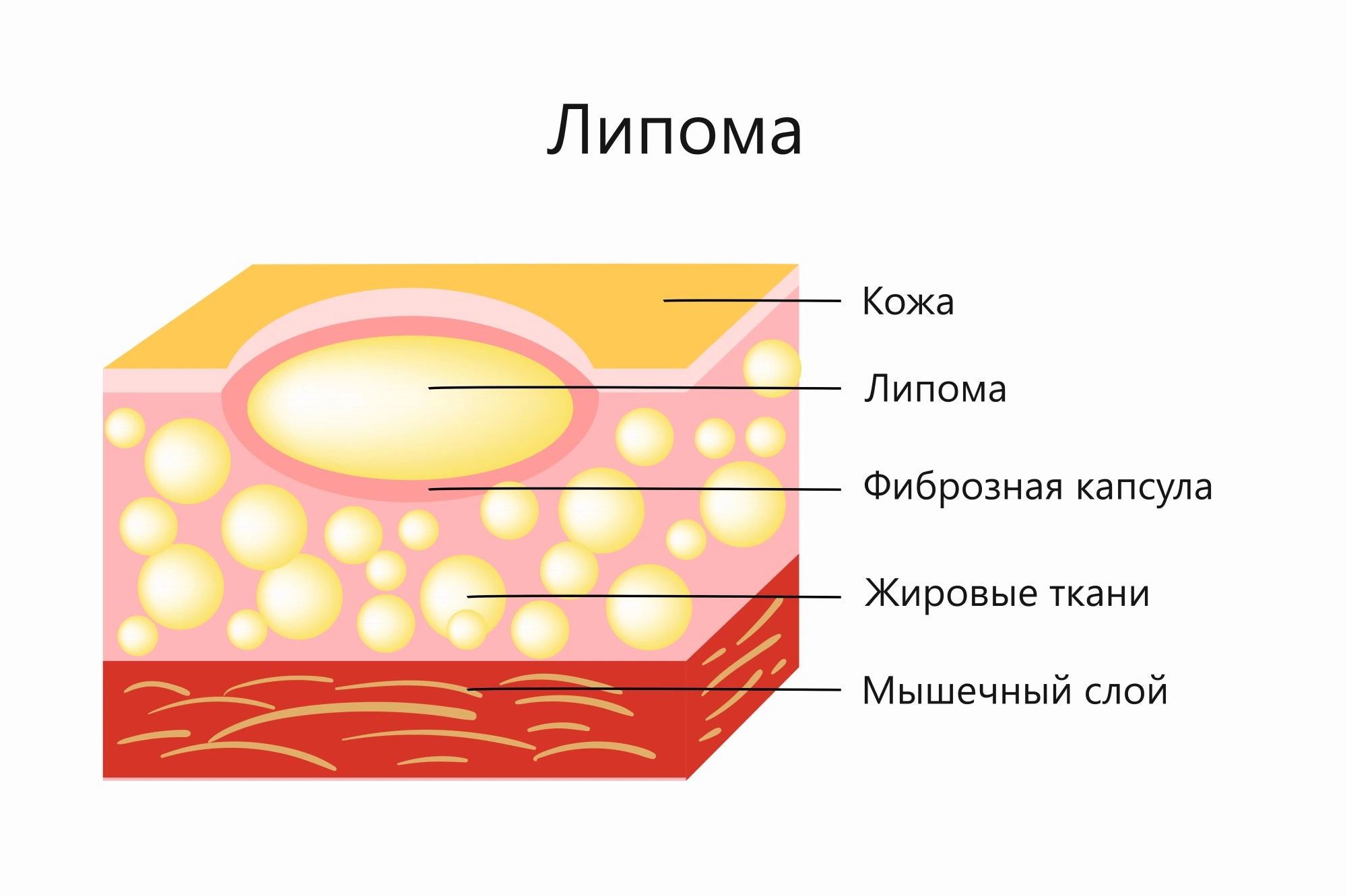 Липома у животных