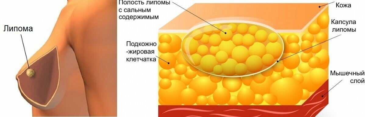 Как выглядит жировик у кошки. липома или жировик у собак и кошек - причины и лечение. что делать, если жировик вскрылся