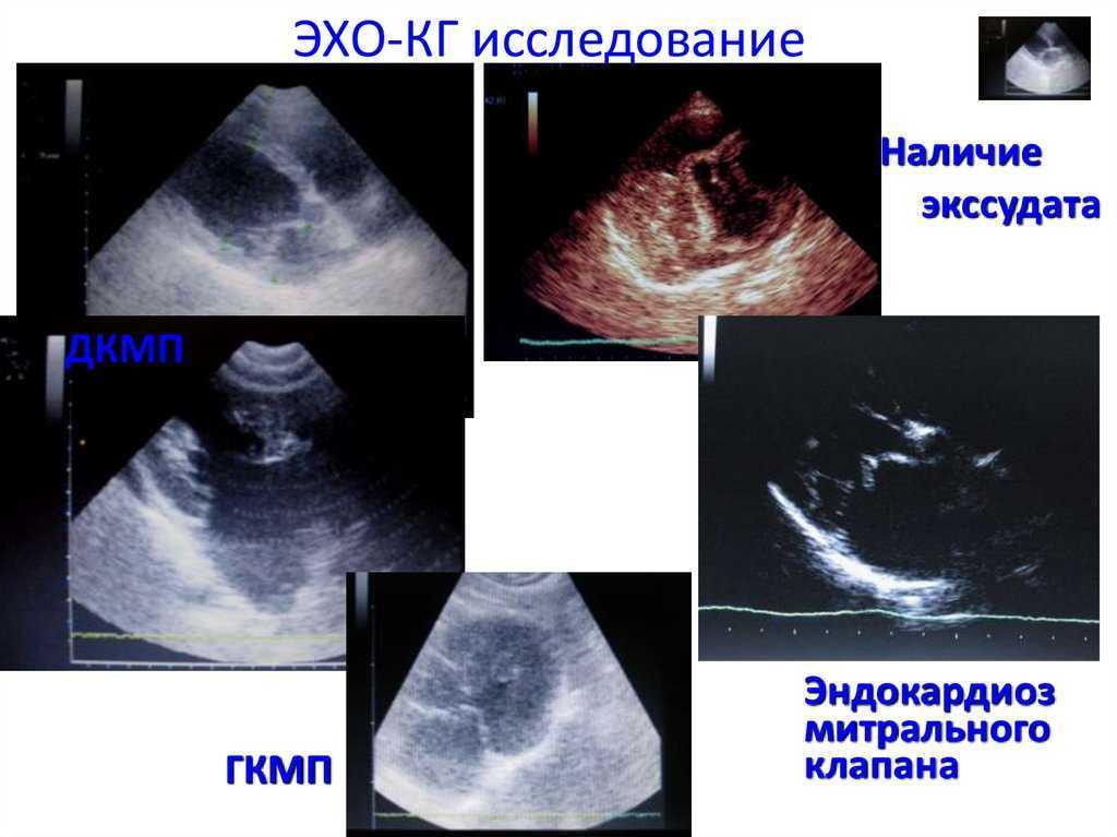 Эндокардиоз у собак - ветеринарный госпиталь