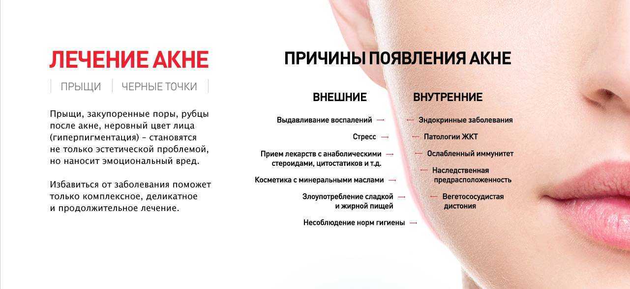 Акне у кошек: причины, симптомы, лечение, осложнения и профилактика | блог ветклиники "беланта"