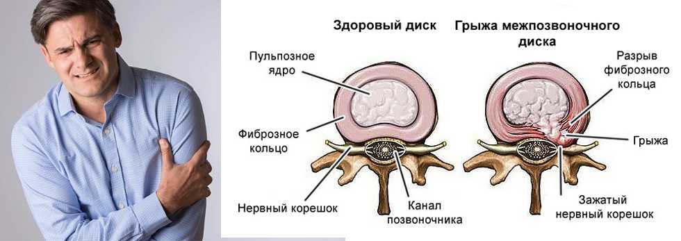 Собака такса: полная характеристика породы, 6 минусов