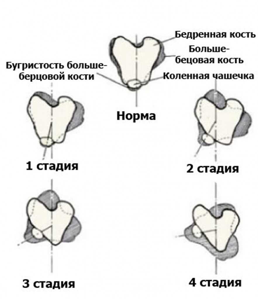 Вывих коленной чашечки у собак: симптомы и лечение | все о собаках